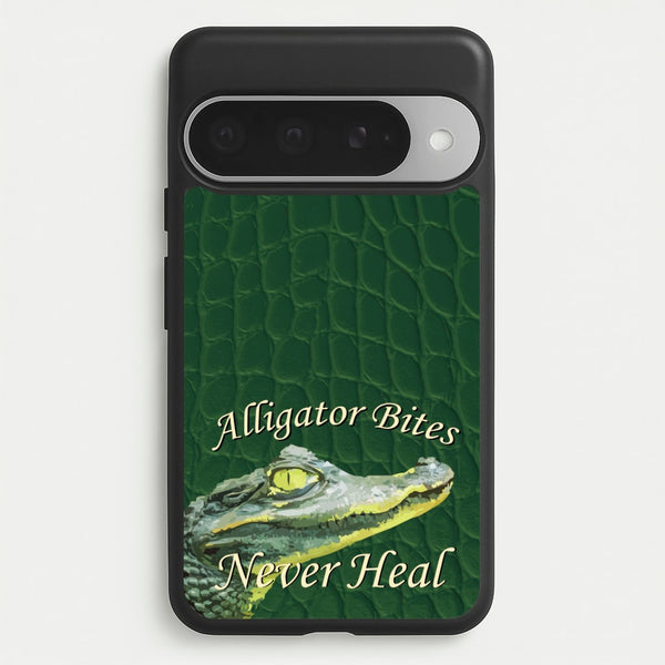 Alligator Bites Never Heal Phone Case for Google Pixel 10 Pro XL