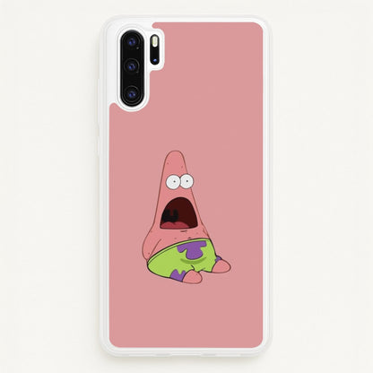 Surprised Patrick  - Spongebob Phone Case for Huawei P30 Pro