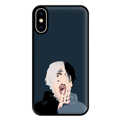 Black And White Hair - Peep Phone Case for iPhone XS Max