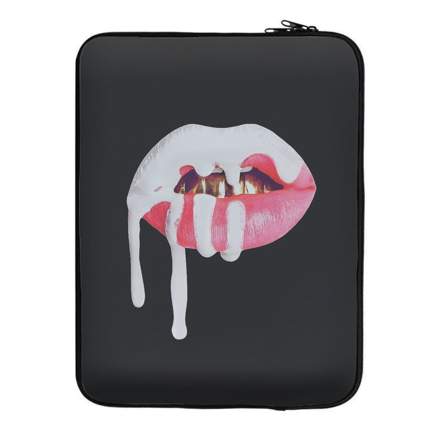 Kylie Jenner - White and Pink Lips Laptop Sleeve
